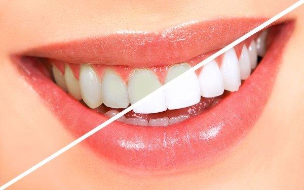 German Dental Center المركز الالماني لطب الاسنان